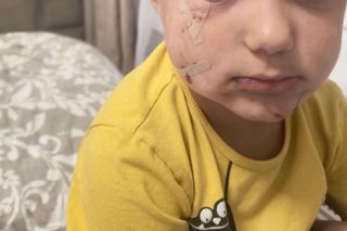 Pogryziony Franek potrzebuje pomocy. Policja szuka właściciela psa. Do szpitala dotarła anonimowa wiadomość