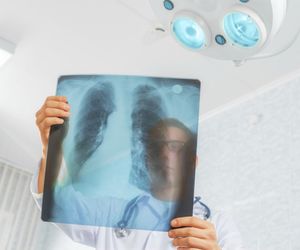 Zapalenie opłucnej - przyczyny, objawy i leczenie