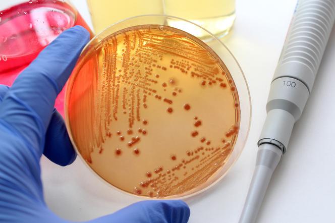 Escherichia coli - w walce z typem bakterii EHEC testowany jest nowy lek