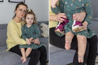 3-letnia Maja przeszła operację i stanęła na własnych nóżkach. Teraz czeka ją kolejna [WIDEO]