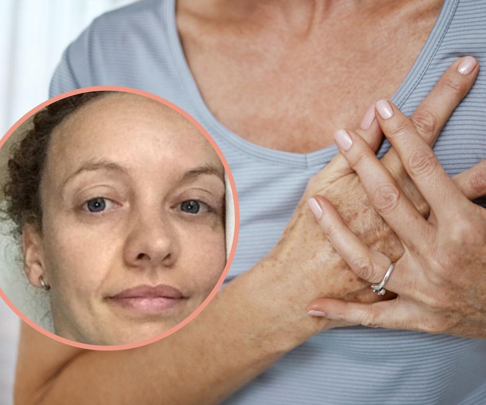 Przeszła dwa zawały przed 40., choć nie była w grupie ryzyka. Chcę, żeby ludzie wiedzieli...
