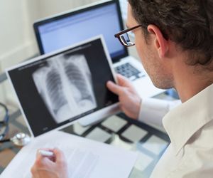 Pylica płuc: przyczyny, objawy, leczenie