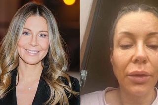 Co się stało z twarzą Rozenek?! Ten widok jest porażający [ZDJĘCIA]