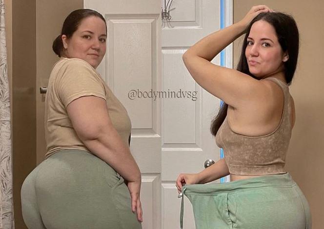 25-latka dzięki operacji bariatrycznej schudła ponad 60 kilogramów