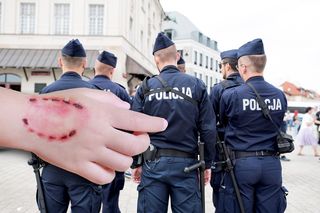 Agresywny 40-latek pogryzł policjanta! Wesoły festyn przerodził się w koszmar