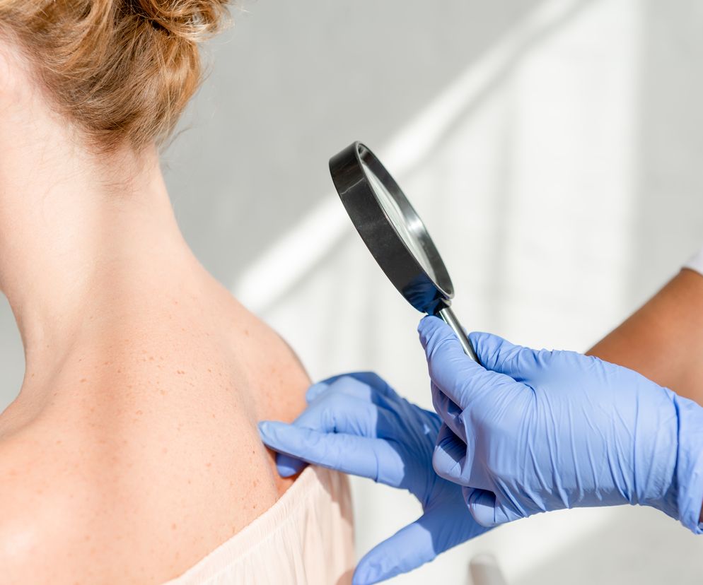 dermatolog bada pacjentkę