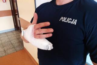 Poznań: ARESZT dla szaleńca, który odgryzł policjantowi palec!