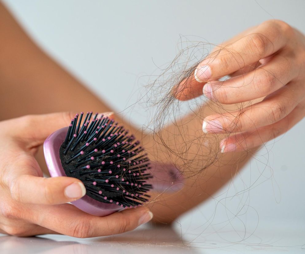 Jakie leki powodują wypadanie włosów? Lekarz ujawnia listę pięciu najgorszych