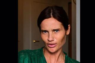  Przeraźliwie chuda Karolina Gilon