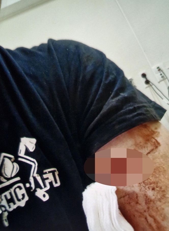 Tu mieszkał Kolumbijczyk, który zabił Polaka! 41-letni Grzegorz zginął od ciosów nożem