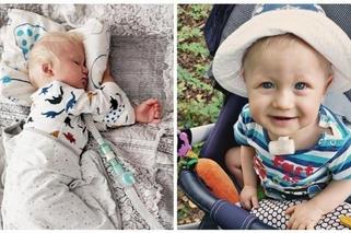 Oluś nie może oddychać gdy śpi. Synek stołecznych policjantów pilnie potrzebuje pomocy