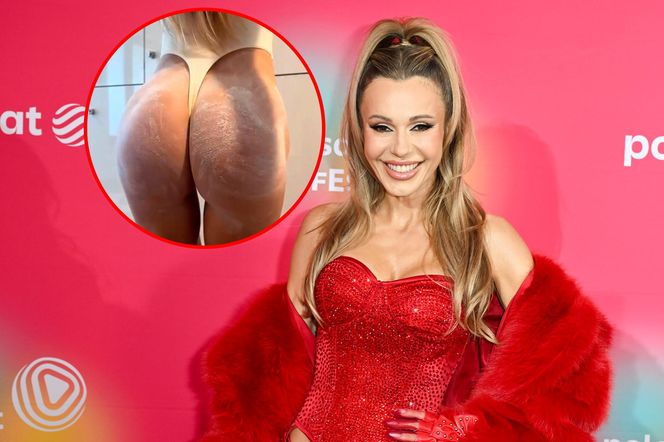 Doda zaświeciła gołą pupą. Co dalej?