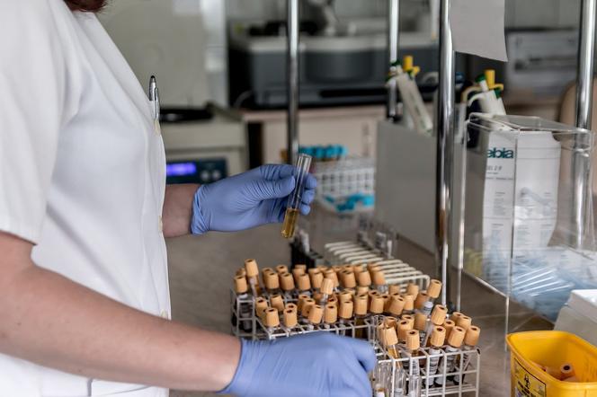 Ogromne kolejki i zapchane laboratoria. Będą limity testów na koronawirusa w Krakowie