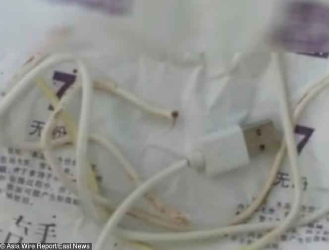 Wsadził sobie ładowarkę w penisa