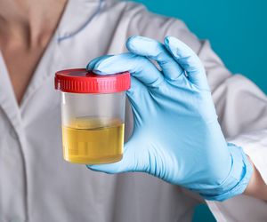 Badanie moczu - analiza ogólna