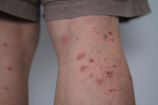 Objaw u 42-latka wydawał się niegroźny. Teraz zostało mu kilka miesięcy życia