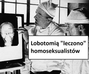 W tych przypadkach stosowano lobotomię