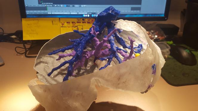 Student UJ drukuje modele wątroby w 3D. To jedyna taka metoda na świecie! [ZDJĘCIA, AUDIO]