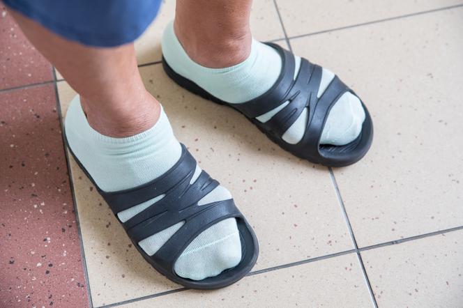 Boję się, że będę miała twarz giganta