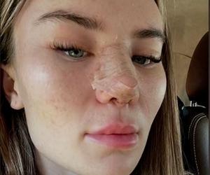 Znana influencerka pojechała do Turcji zrobić sobie nos. Wydała 50 tys. zł, fani bezlitośni: Jest gorzej