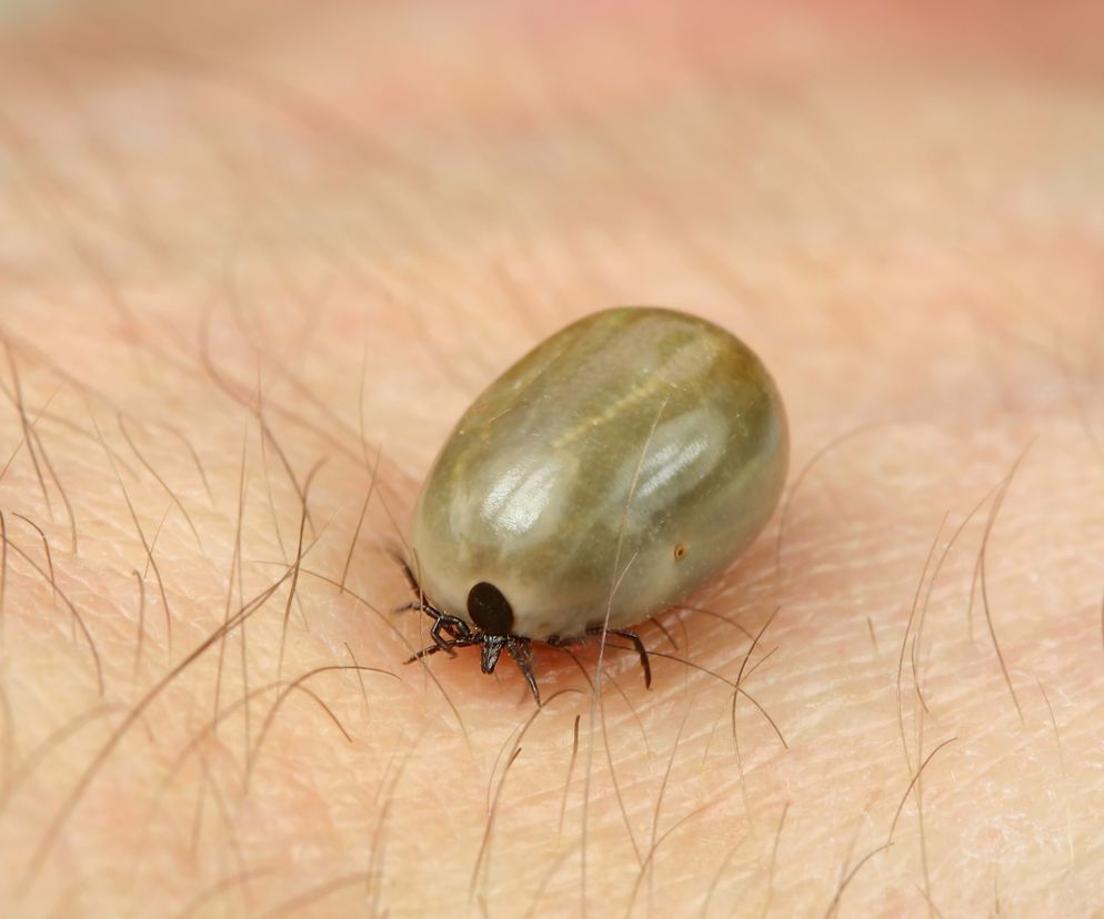 Anaplazmoza to choroba odkleszczowa. Objawy i leczenie anaplazmozy