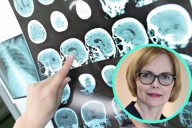 Pacjenci z SM odzyskali przyszłość. Czy system pozwoli im ją zatrzymać?