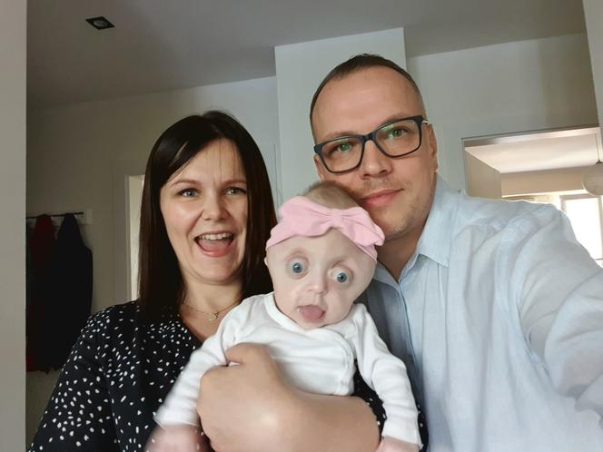 Mówili im: Pani dziecko to potwór, lepiej żeby umarło. Rodzice WALCZĄ o małą Hanię!