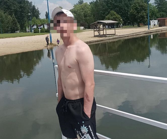 Horror na imprezie. Krystian został znienacka skatowany. Bandzior skakał mu po głowie