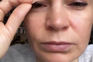 Joanna Górska wycięła sobie powieki. Drastyczne zdjęcia 