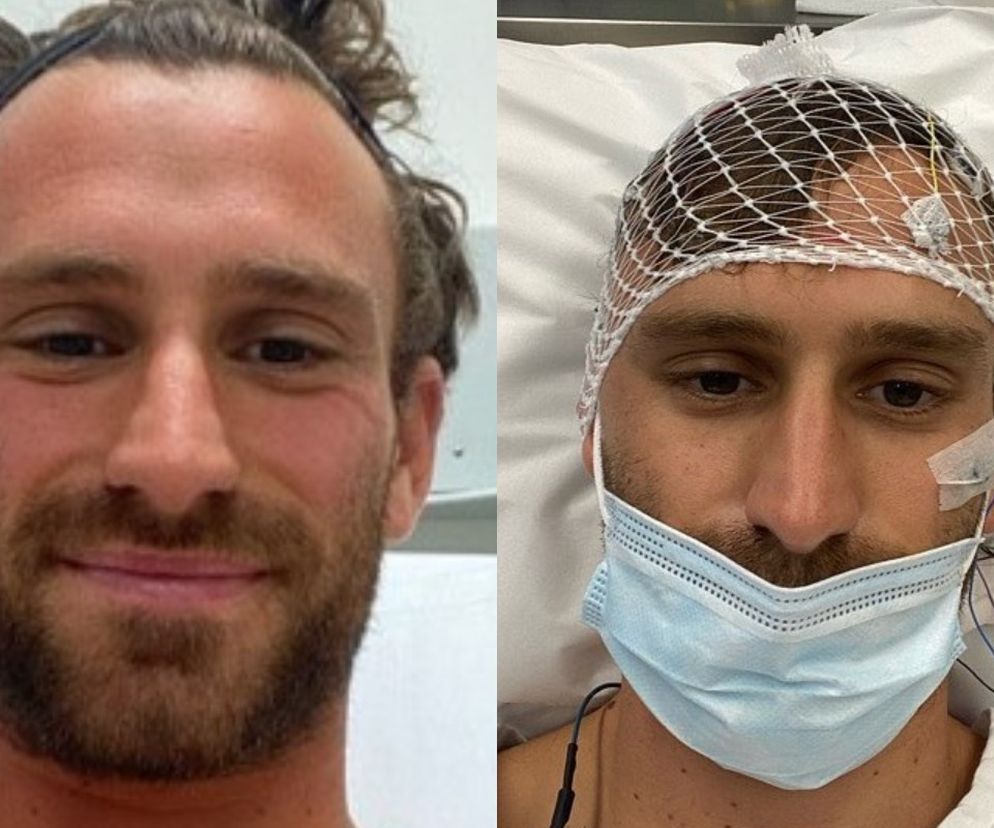 Myślał, że to choroba zatok. Miał agresywnego guza mózgu