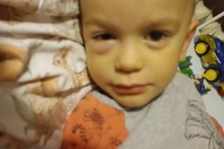 3-letni Wojtuś walczy z ETMR. Nadzieją jest zagraniczna terapia