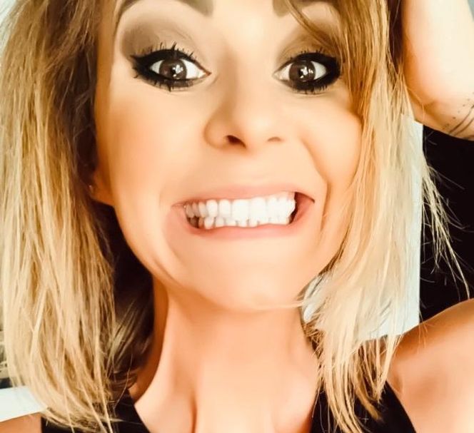 Katarzyna Skowrońska przeszła operację plastyczną