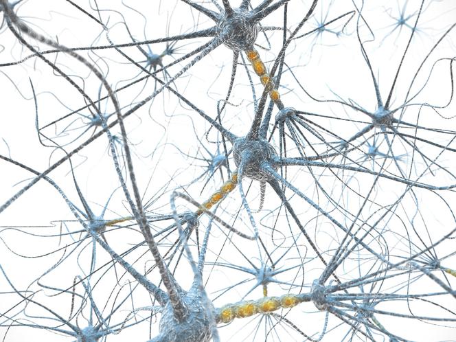 Mononeuropatia to uszkodzenie nerwu, przekazującego informacje z mózgu do innych narządów