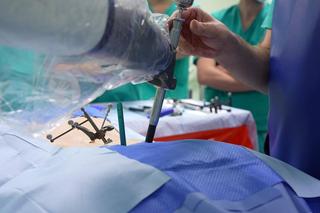 Ponad sto operacji kręgosłupów z udziałem robota w szpitalu wojewódzkim w Szczecinie