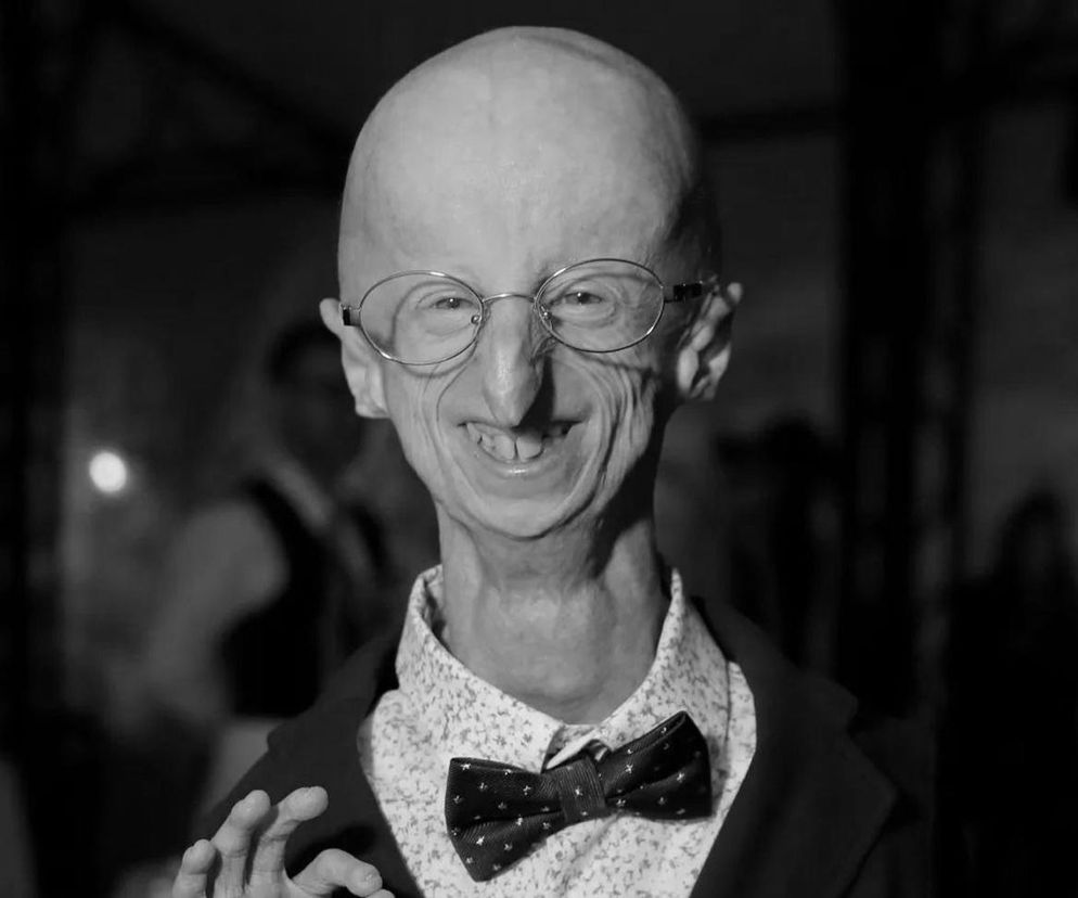 Nie żyje Sammy Basso. Cierpiał na niezwykle rzadką chorobę Benjamina Buttona