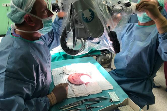 Przyszyli 7-latce skalp. Operacja trwała 7 godzin!