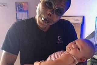 Mężczyzna usunął nos i uszy, aby wyglądać jak żywy trup