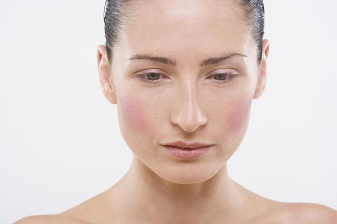 Skóra alergiczna - charakterystyka. Jak pielęgnować alergiczną cerę?
