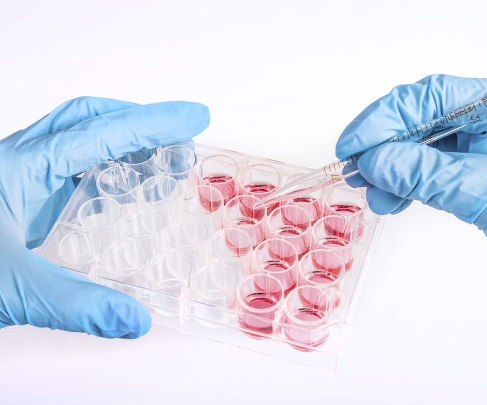Sprawdź, jakie są normy ALAT w badaniu biochemicznym i o czym może świadczyć wzrost aktywności ALAT.
