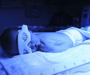 ŻÓŁTACZKA fizjologiczna noworodków