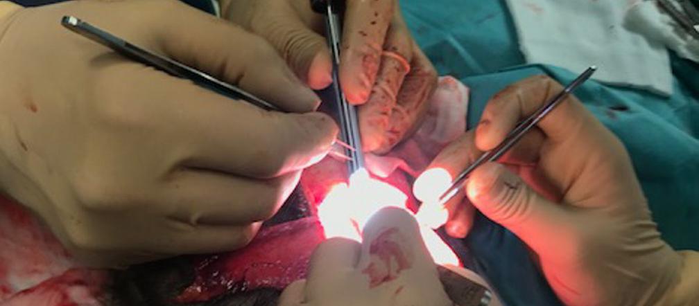 Przyszyli 7-latce skalp. Operacja trwała 7 godzin!