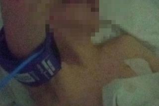 Ostrze noża minęło serce Kacpra o dwa centymetry. Zaatakował go 12-letni chłopiec