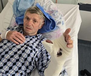 Sekunda nieuwagi i tragedia. Albo palec, albo papierosy