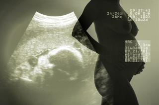 Badanie ultrasonograficzne w ciąży: USG 3D i 4D, czyli podglądanie dziecka na ekranie