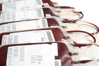 W Wielkopolsce brakuje krwi!​ Szpitale w regionie najwięcej potrzebują obecnie tej z grup ujemnych