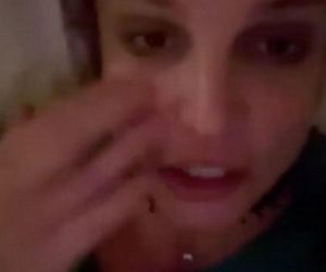 Britney Spears spaliła sobie twarz! Wypadek gwiazdy przy kominku