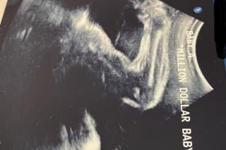 47-letnia Hilary Swank przekazała radosną nowinę w święta. Urodziła bliźnięt