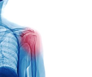 Staw ramienny - anatomia, funkcje i przyczyny bólu