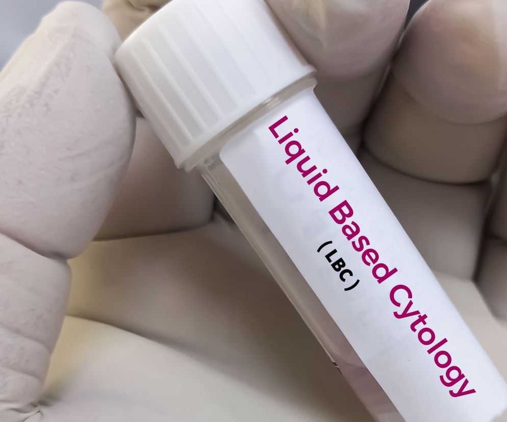Cytologia płynna - nowoczesna technika diagnostyki raka szyjki macicy