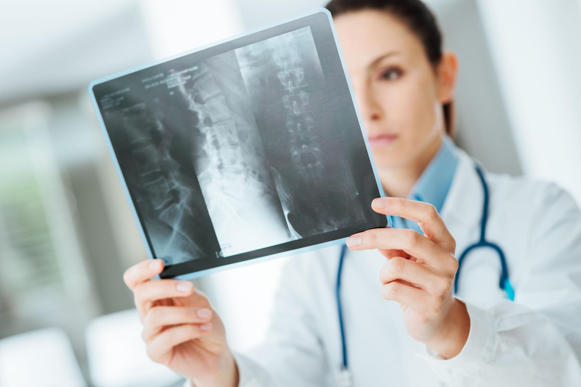 Radiolog Czym Się Zajmuje Rodzaje Badań Radiologicznych Poradnikzdrowiepl 9964